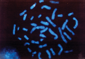Photomicrograph of less-thanigreater-thanBRCA2less-thanslashigreater-than gene on chromosome 13 red and green probes Photo copyright  Dorothy Warburton PhDslashPhototake
