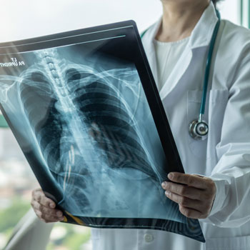 Spirometry and a good old-fashioned chest X-ray can provide a wealth of information for clinicians trying to pinpoint a dyspnea diagnosis said Matthew Griffith MD MPH Image by Adobe Stock-Chinnapong